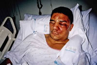 Rodney King beaten