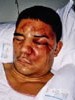 Rodney King beaten